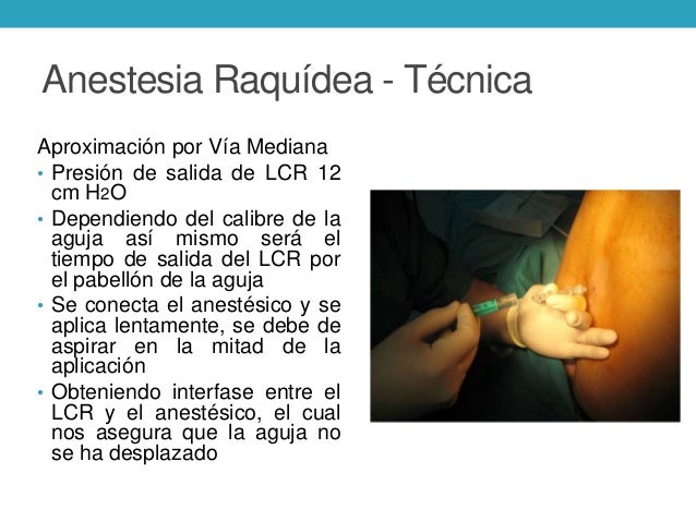 anestesia conductiva